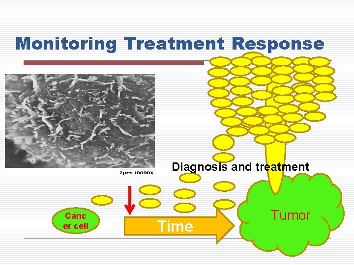 Monitoring Treatment Response Diagnosis and treatment Canc er cell Time Tumor 