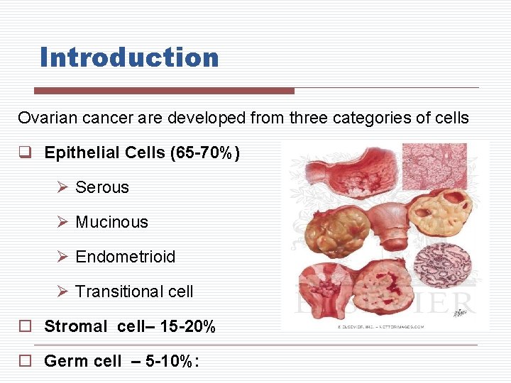 Introduction Ovarian cancer are developed from three categories of cells q Epithelial Cells (65