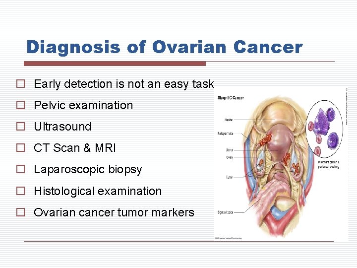Diagnosis of Ovarian Cancer o Early detection is not an easy task o Pelvic