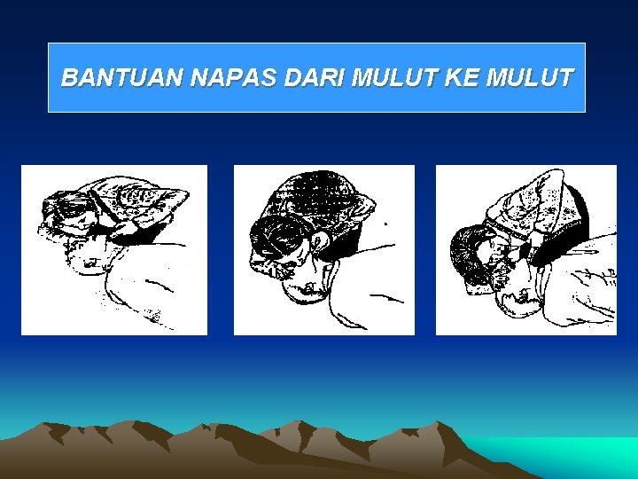 BANTUAN NAPAS DARI MULUT KE MULUT 