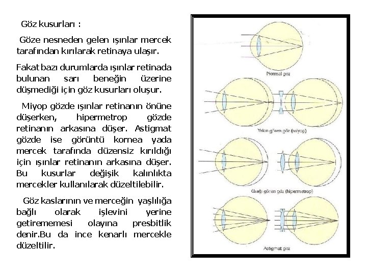 Göz kusurları : Göze nesneden gelen ışınlar mercek tarafından kırılarak retinaya ulaşır. Fakat bazı