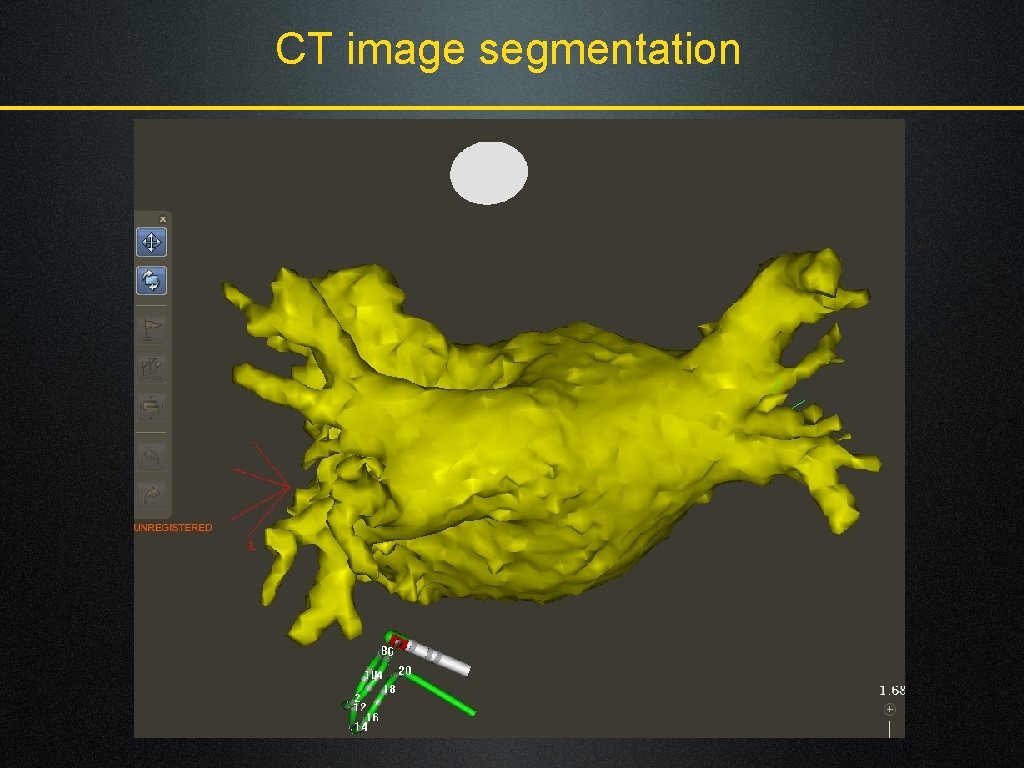 CT image segmentation 