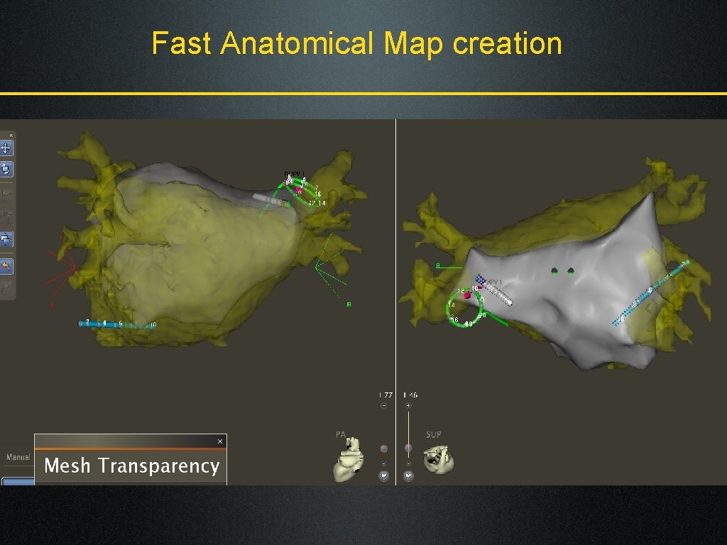 Fast Anatomical Map creation 