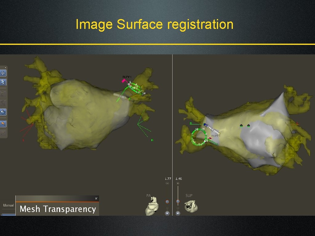 Image Surface registration 