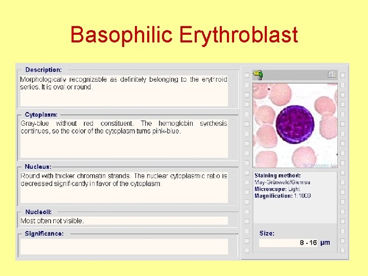 Basophilic Erythroblast 