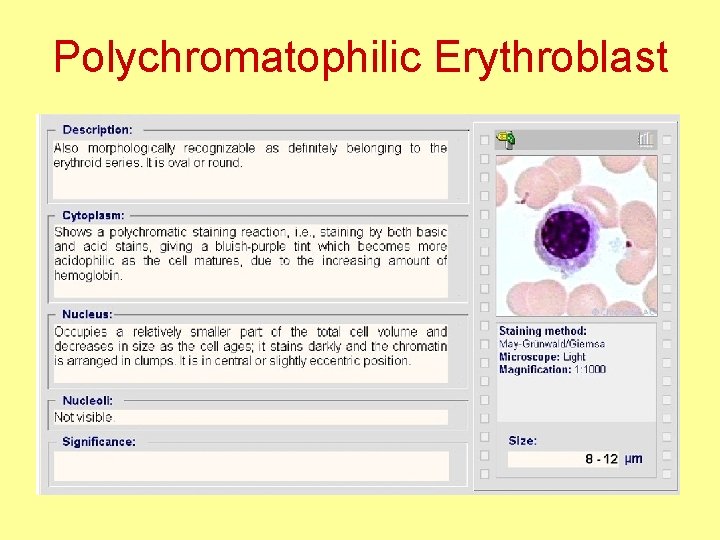 Polychromatophilic Erythroblast 