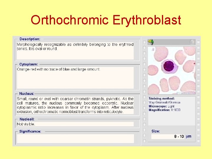 Orthochromic Erythroblast 