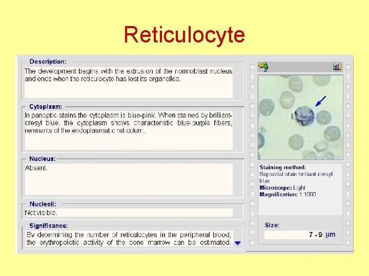 Reticulocyte 