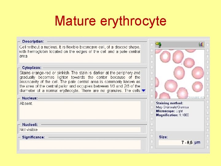 Mature erythrocyte 
