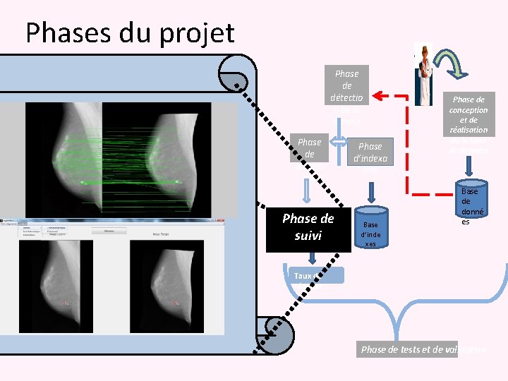 Phases du projet Phase de détectio n de la tumeur Phase de diagno stic