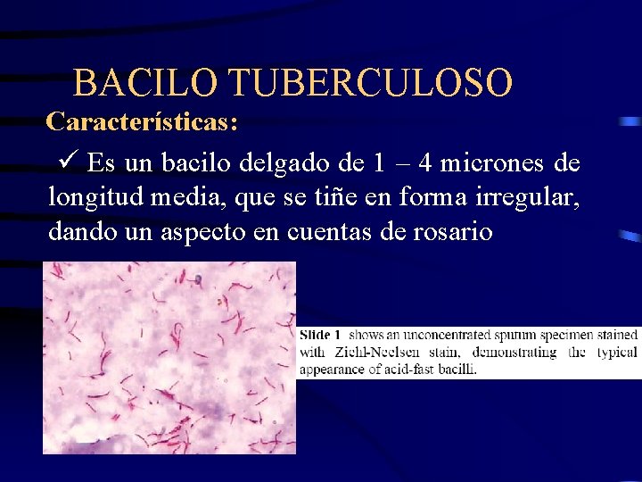 BACILO TUBERCULOSO Características: Es un bacilo delgado de 1 – 4 micrones de longitud