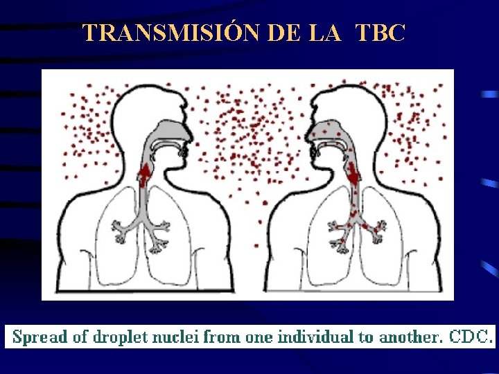 TRANSMISIÓN DE LA TBC 