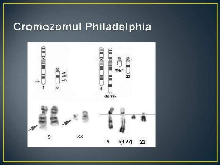 Cromozomul Philadelphia 