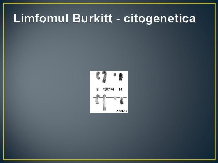 Limfomul Burkitt - citogenetica 