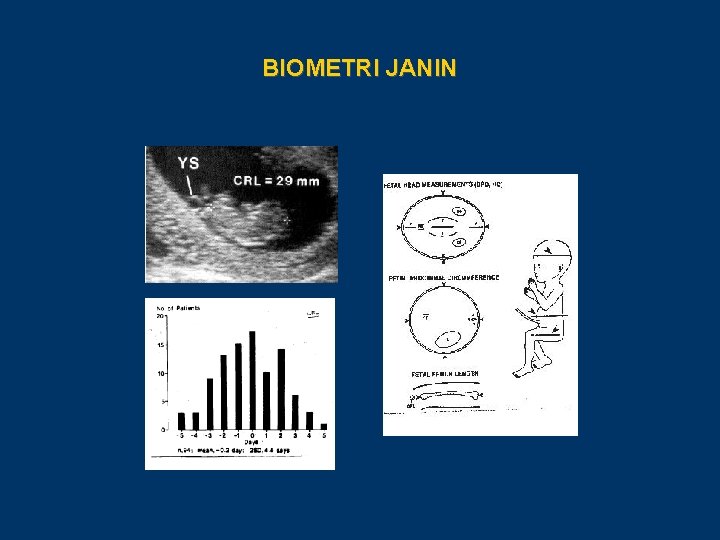 BIOMETRI JANIN 