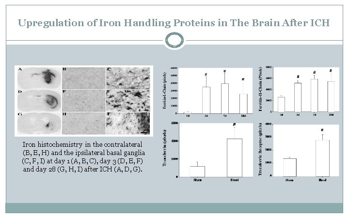 Upregulation of Iron Handling Proteins in The Brain After ICH Iron histochemistry in the