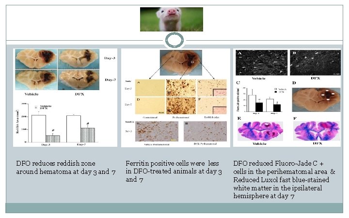 DFO reduces reddish zone around hematoma at day 3 and 7 Ferritin positive cells