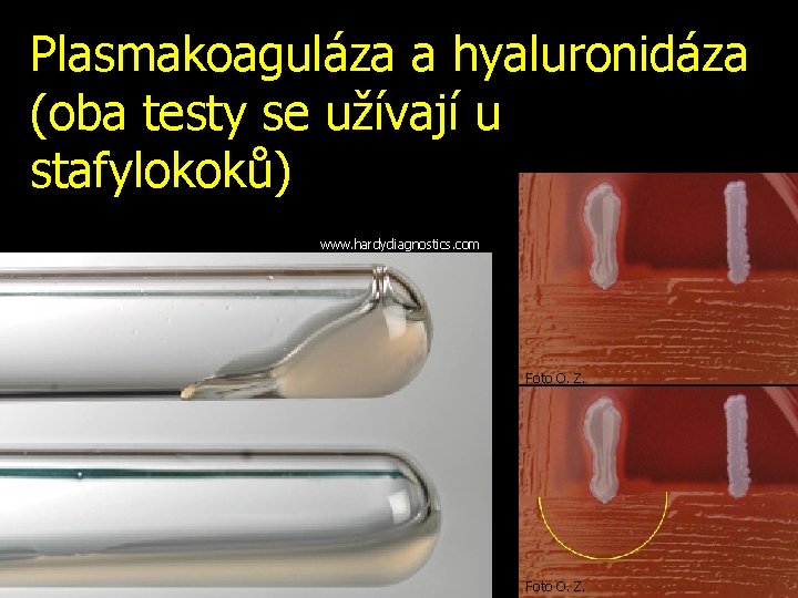 Plasmakoaguláza a hyaluronidáza (oba testy se užívají u stafylokoků) www. hardydiagnostics. com Foto O.