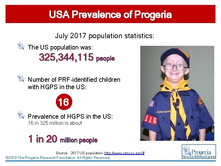 USA Prevalence of Progeria July 2017 population statistics: The US population was: 325, 344,