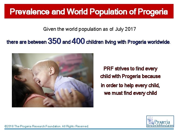 Prevalence and World Population of Progeria Given the world population as of July 2017