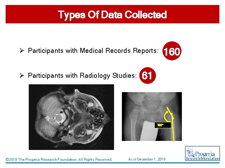 Types Of Data Collected Ø Participants with Medical Records Reports: Ø Participants with Radiology