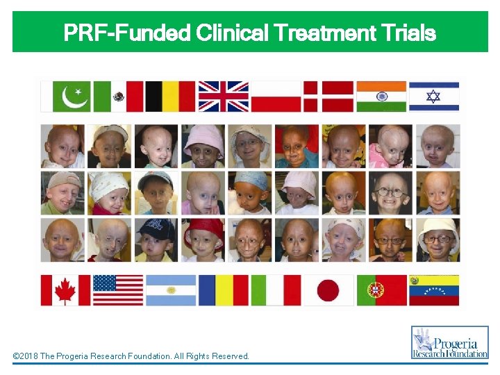 PRF-Funded Clinical Treatment Trials © 2018 The Progeria Research Foundation. All Rights Reserved. 