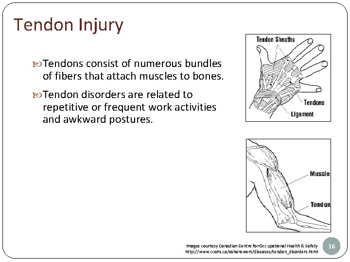 Tendon Injury Tendons consist of numerous bundles of fibers that attach muscles to bones.