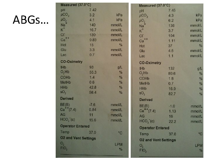 ABGs… 