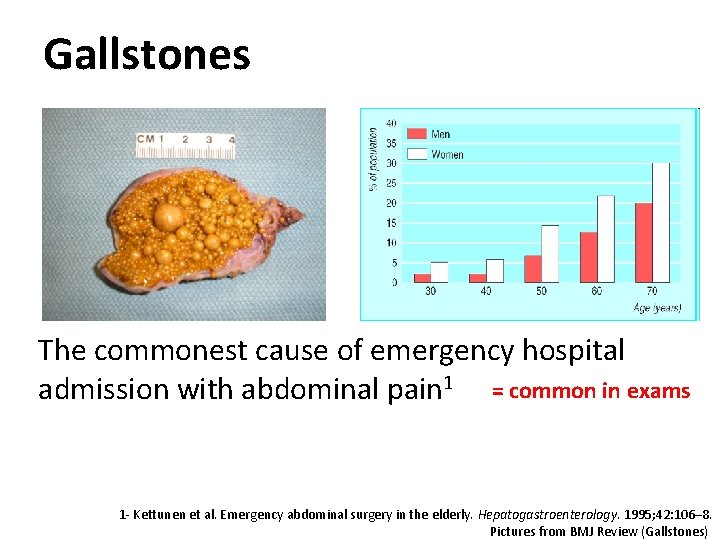 Gallstones The commonest cause of emergency hospital admission with abdominal pain 1 = common