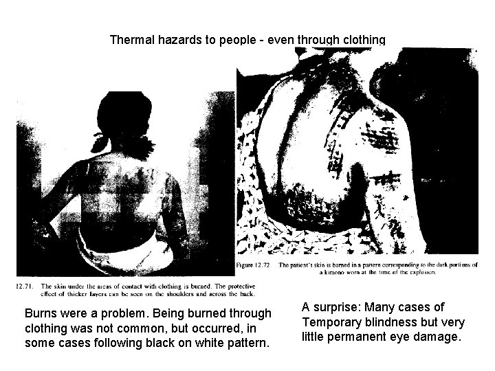 Thermal hazards to people - even through clothing Burns were a problem. Being burned
