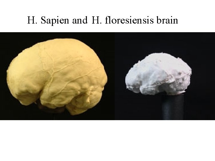 H. Sapien and H. floresiensis brain 