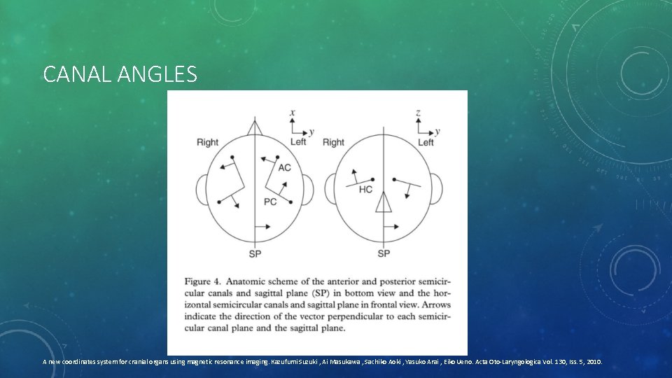 CANAL ANGLES A new coordinates system for cranial organs using magnetic resonance imaging. Kazufumi
