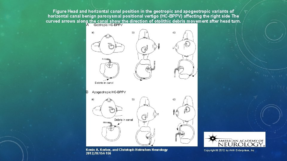 Figure Head and horizontal canal position in the geotropic and apogeotropic variants of horizontal