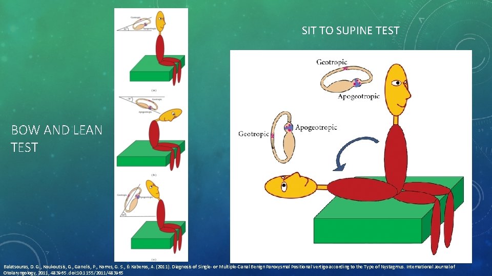 SIT TO SUPINE TEST BOW AND LEAN TEST Balatsouras, D. G. , Koukoutsis, G.