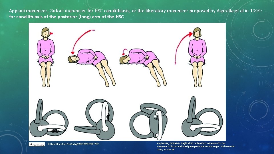 Appiani maneuver, Gufoni maneuver for HSC canalithiasis, or the liberatory maneuver proposed by Asprella