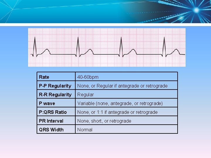 Rate 40 -60 bpm P-P Regularity None, or Regular if antegrade or retrograde R-R