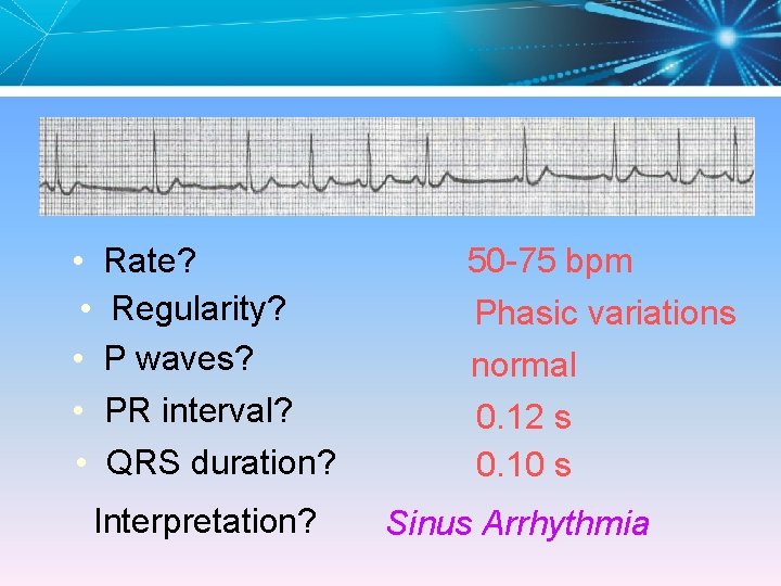  • Rate? • Regularity? • P waves? • PR interval? • QRS duration?