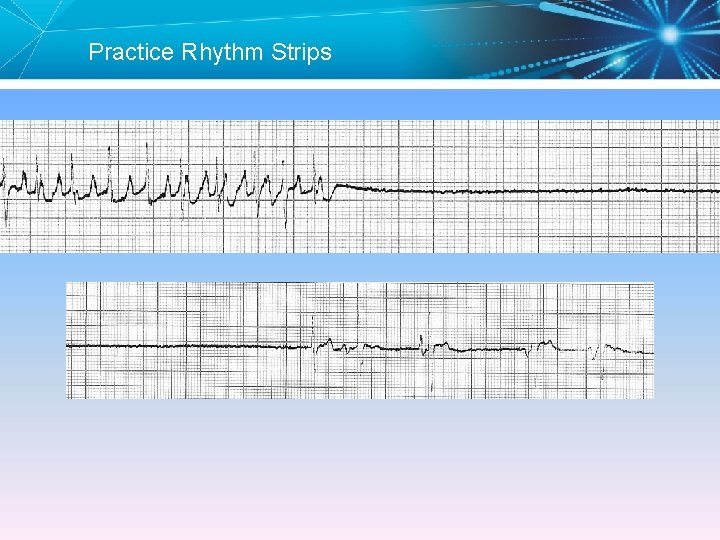 Practice Rhythm Strips 