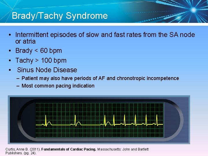 Brady/Tachy Syndrome • Intermittent episodes of slow and fast rates from the SA node