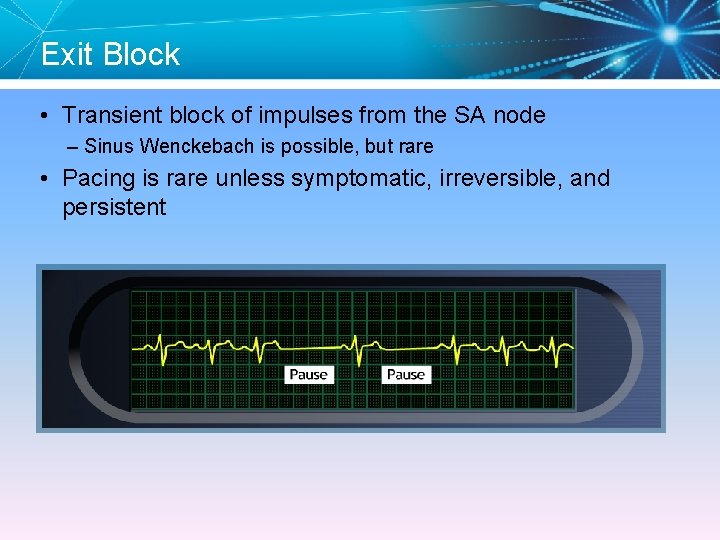 Exit Block • Transient block of impulses from the SA node – Sinus Wenckebach