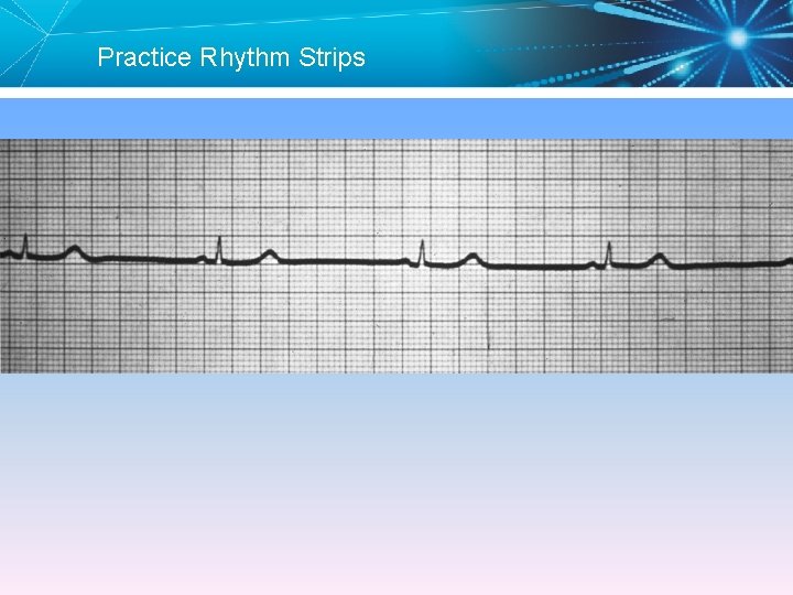 Practice Rhythm Strips 