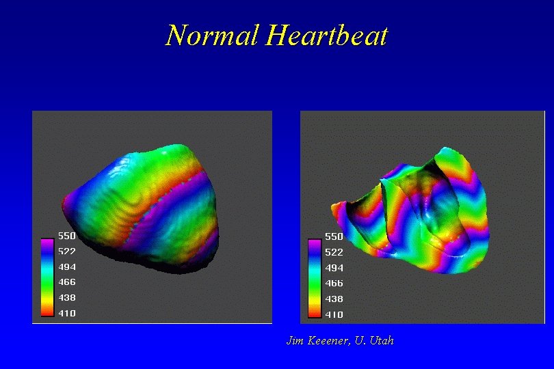Normal Heartbeat Jim Keeener, U. Utah Normal Heartbeat Jim Keeener, U. Utah