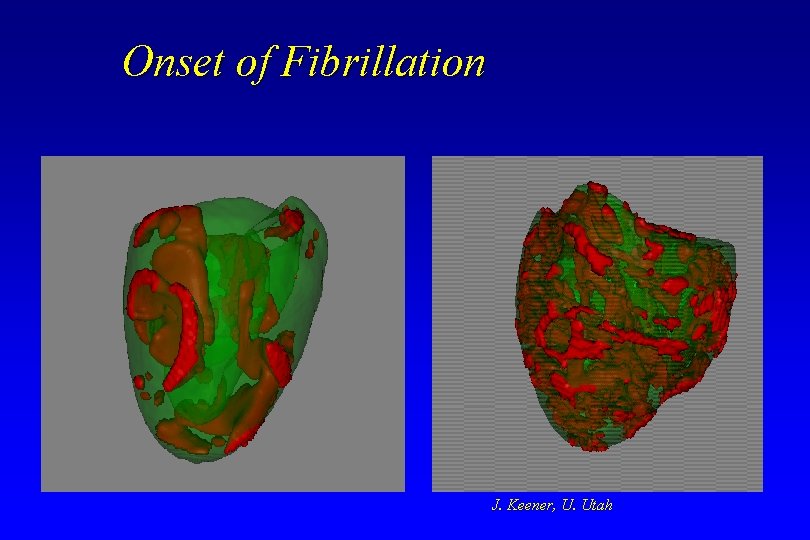 Onset of Fibrillation J. Keener, U. Utah Onset of Fibrillation J. Keener, U. Utah