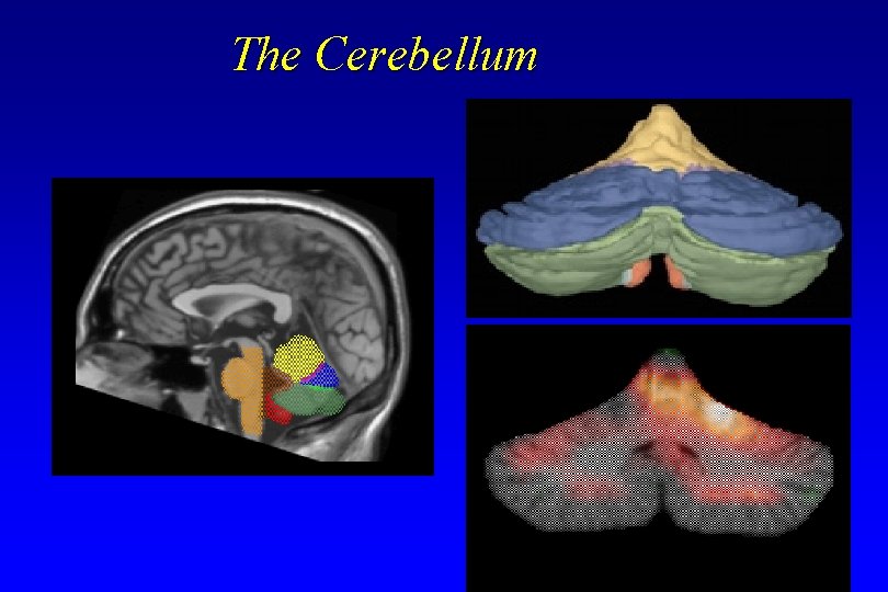 The Cerebellum The Cerebellum