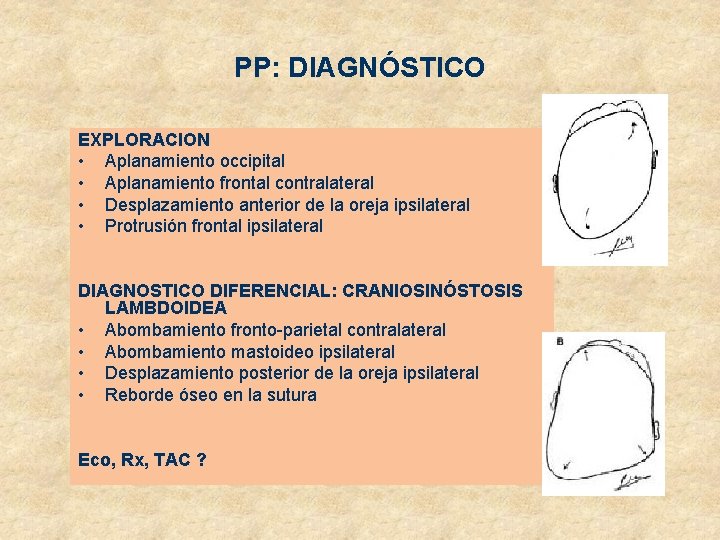 PP: DIAGNÓSTICO EXPLORACION • Aplanamiento occipital • Aplanamiento frontal contralateral • Desplazamiento anterior de