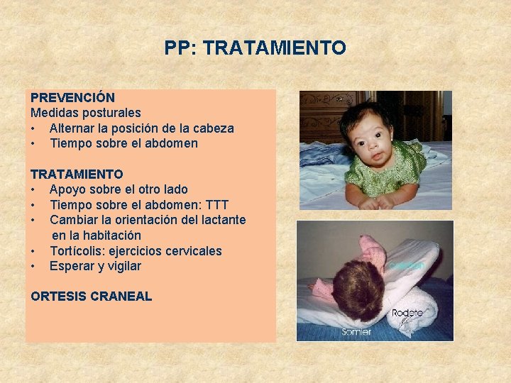 PP: TRATAMIENTO PREVENCIÓN Medidas posturales • Alternar la posición de la cabeza • Tiempo