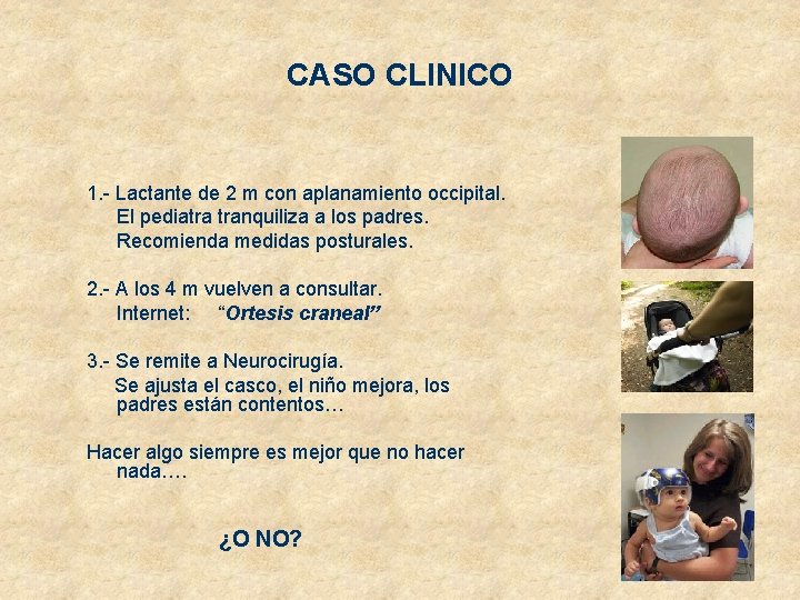 CASO CLINICO 1. - Lactante de 2 m con aplanamiento occipital. El pediatra tranquiliza