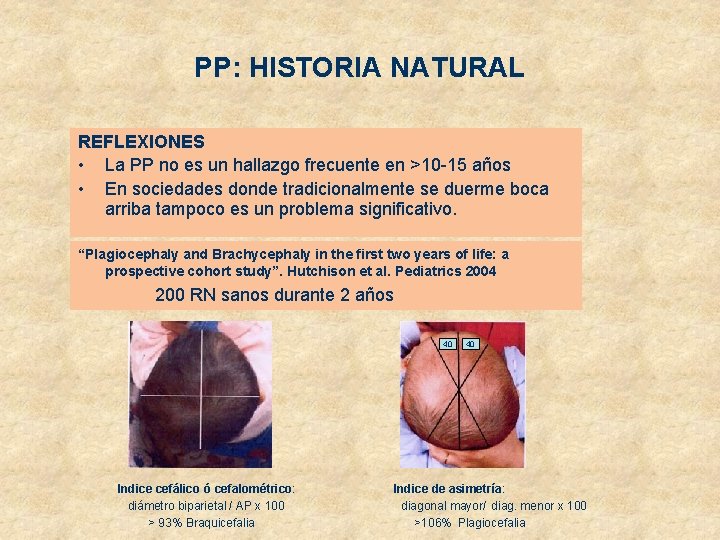 PP: HISTORIA NATURAL REFLEXIONES • La PP no es un hallazgo frecuente en >10