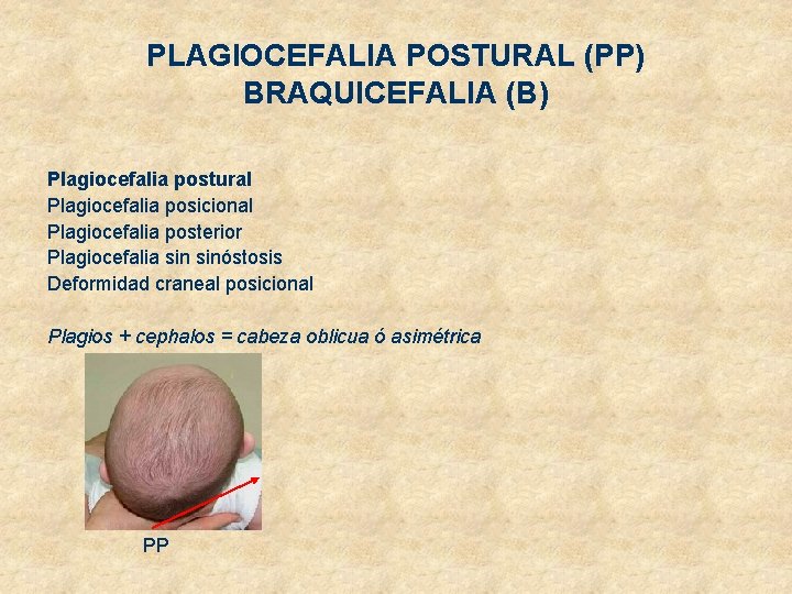 PLAGIOCEFALIA POSTURAL (PP) BRAQUICEFALIA (B) Plagiocefalia postural Plagiocefalia posicional Plagiocefalia posterior Plagiocefalia sinóstosis Deformidad