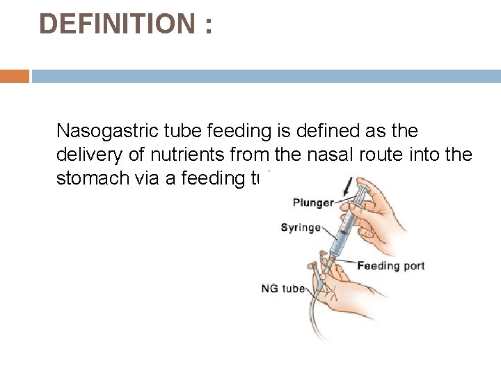 DEFINITION : Nasogastric tube feeding is defined as the delivery of nutrients from the